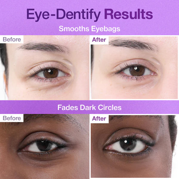 numbuzin No.9 NAD+ Collagen Under Eye Patches - 5 Patches