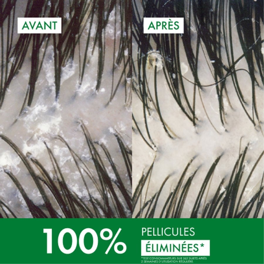 DERCOS SHAMPOOING ANTI-PELLICULAIRE DS - CHEVEUX NORMAUX À GRAS